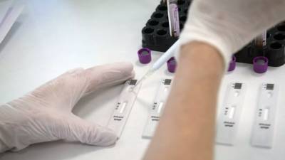 Геннадий Онищенко - Более 28,1 млн тестов на коронавирус проведено в России - russian.rt.com - Россия