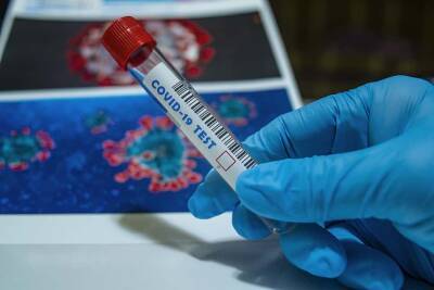Ученые узнали, как убить коронавирус за 2 секунды и мира - cursorinfo.co.il - Израиль - Jerusalem