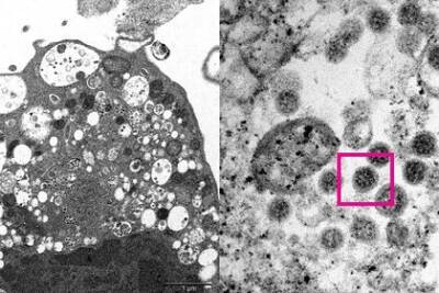 Ученым удалось сфотографировать омикрон-штамм коронавируса - lenta.ru - Лондон - Гонконг