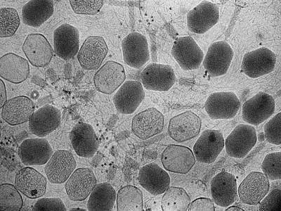 На бактериях из кишечника человека паразитируют более 140 тысяч видов бактериофагов - polit.ru - Франция