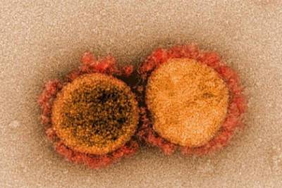 Разработан новый эффективный способ борьбы с коронавирусом - lenta.ru - штат Канзас