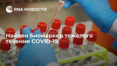 Американские ученые предложили сфингозин в качестве биомаркера, определяющего тяжесть COVID-19 - ria.ru - Москва - Сша - штат Южная Каролина