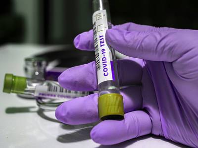 Американские медики узнали, как предсказать тяжесть течения коронавируса - rosbalt.ru - штат Южная Каролина