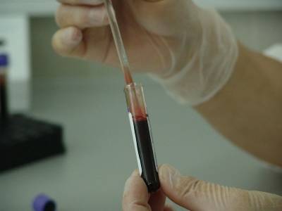 Ученые научились предсказывать тяжелую форму коронавируса заранее - bloknot.ru - штат Южная Каролина