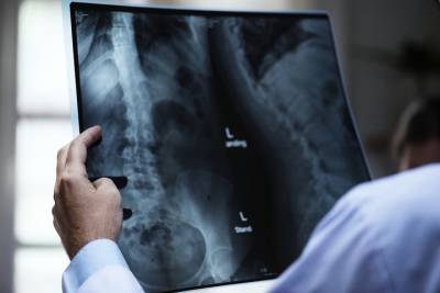 Столичные рентгенологи проанализировали более трех миллионов исследований с помощью ИИ - vm.ru - Москва