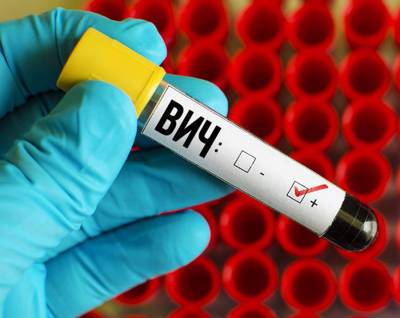 За восемь месяцев 2021 года в Беларуси зарегистрировано 1013 новых случаев ВИЧ-инфекции - naviny.by - Белоруссия - Гомельская обл.
