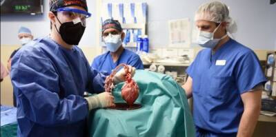 В США человеку впервые успешно пересадили сердце свиньи - eadaily.com - Сша - штат Мэриленд