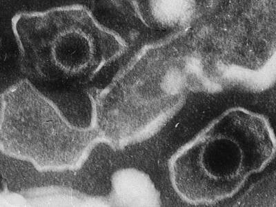 Возможным триггером рассеянного склероза назвали вирус Эпштейна — Барр - polit.ru - Сша - Англия