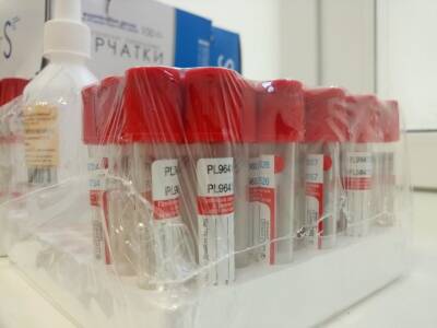Новый анализ крови позволит предсказать риск смерти от коронавируса - ufacitynews.ru - Германия - Австрия - Берлин