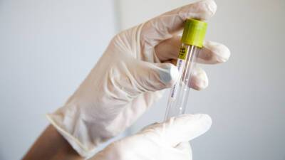 В Германии за сутки выявили рекордные 133,5 тысячи случаев заражения коронавирусом - mir24.tv - Германия