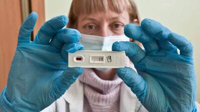 Автоматизированный ПЦР-тест быстро выявит ВИЧ по клеткам крови - iz.ru - Россия - Израиль