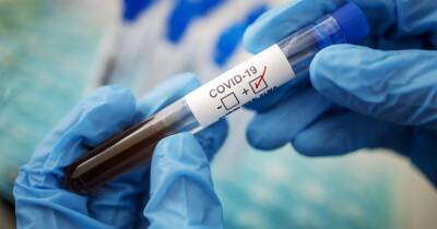 ВИЧ-инфицированная женщина болела коронавирусом 9 месяцев и накопила в своем организме 21 мутацию - focus.ua - Украина - Юар - Кейптаун