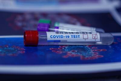Стало известно, почему результаты теста на коронавирус могут буть ошибочными - abnews.ru