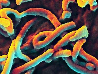 Вирус лихорадки Эбола может годами сохраняться в мозге человека - polit.ru - Сша - Гвинея
