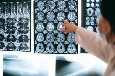 Российские ученые сообщили о неврологических аномалиях мозга у переболевших коронавирусом - argumenti.ru