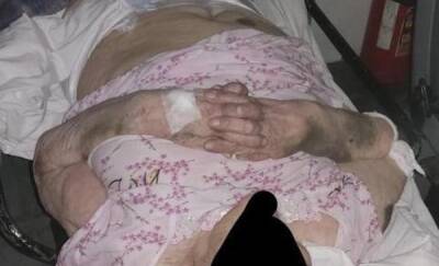 93-летнего ветерана выписали из больницы обезвоженной, полураздетой и с синяками по всему телу - news.megatyumen.ru - Сургут - округ Югра