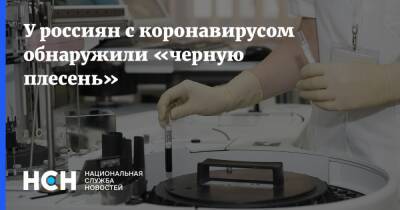 У россиян с коронавирусом обнаружили «черную плесень» - nsn.fm - Тюмень