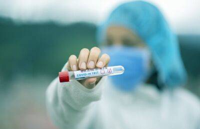 За сутки в КНДР зарегистрировали более 296 тыс. новых пациентов с симптомами «незнакомой лихорадки» - ont.by - Белоруссия - Кндр