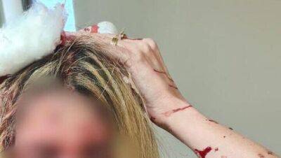 Пациент разбил голову женщине-врачу в Беэр-Яакове за просьбу выйти из кабинета - vesty.co.il - Израиль