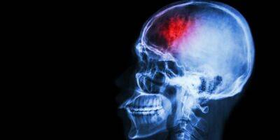 Ковид увеличивает вероятность развития трех опаснейших болезней мозга - nv.ua - Украина - Сша - Дания