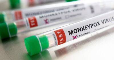 В ЕС предварительно одобрили первую вакцину от обезьяньей оспы - rus.delfi.lv - Франция - Сша - Германия - Канада - Испания - Голландия - Латвия - Португалия - Дания