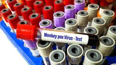 Адан Тедрос - Израиль готовится к вакцинации от оспы обезьян - vesty.co.il - Сша - Израиль - Минздрав
