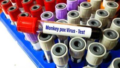 Невероятно: мужчина одновременно заразился оспой обезьян, коронавирусом и ВИЧ - vesty.co.il - Италия - Испания - Израиль