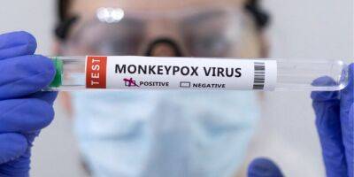 Сша - В США объявили чрезвычайную ситуацию из-за вспышки оспы обезьян - nv.ua - Украина - Сша - Нью-Йорк - штат Калифорния