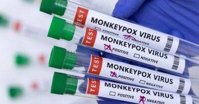 В Латвии стали доступны прививки от обезьяньей оспы: вакцинацию можно пройти в 10 больницах - rus.delfi.lv - Латвия - Рига