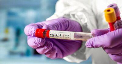 Тяжелое течение COVID-19: вирус может оказаться в мозге и других частях тела - dsnews.ua - Сша