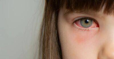 Берегите глаза. Ученые рассказали о странном симптоме нового варианта COVID-19 - focus.ua - Украина - Сша - Индия - Лос-Анджелес - штат Калифорния
