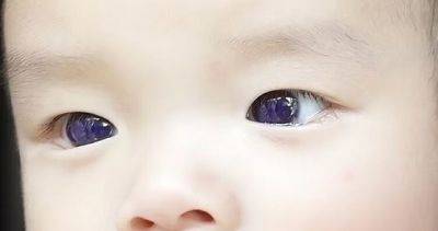 В Таиланде у кареглазого младенца после лечения от COVID-19 фавипиравиром посинели глаза - dialog.tj - Россия - Украина - Казахстан - Италия - Япония - Индия - Молдавия - Узбекистан - Таиланд - Азия